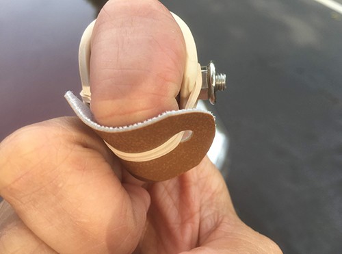 A custom finger splint can help you recover from injuries such as fractures