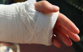 Hand fracture in a cast