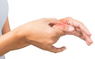 A person suffering from a trigger thumb