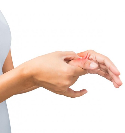 Trigger Finger: Causes, Symptoms, Treatment and Exercises