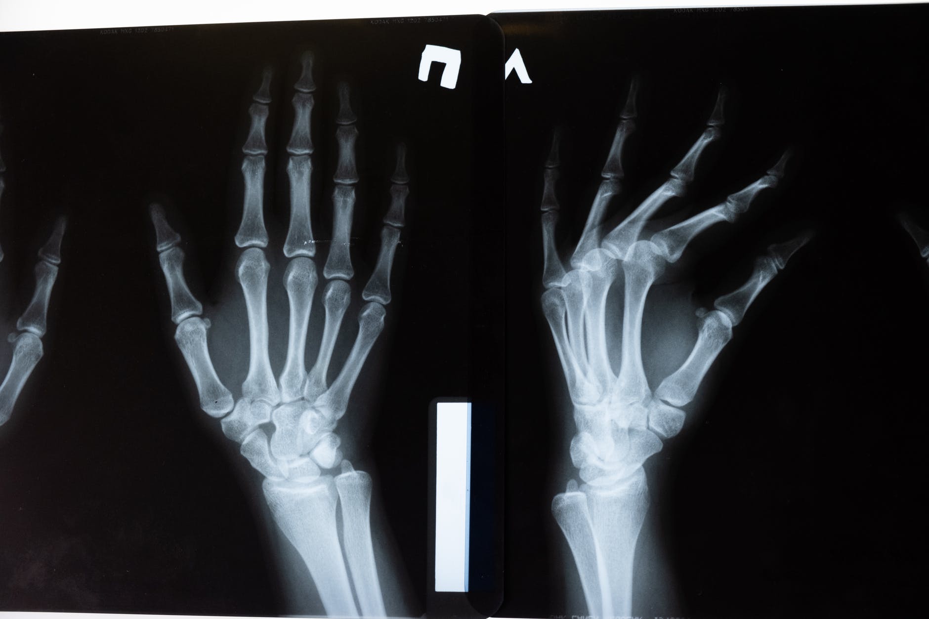 X-ray images of hands.