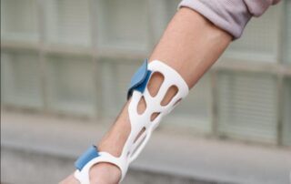 A splint on the hand