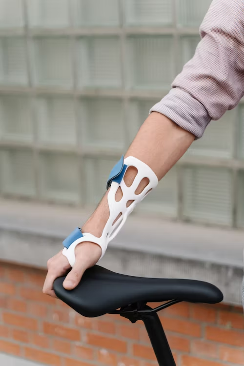 An individual wearing a custom static splint on their wrist